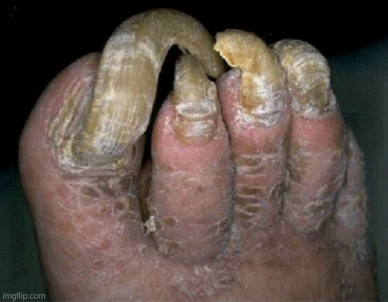 Toenails | image tagged in toenails | made w/ Imgflip meme maker