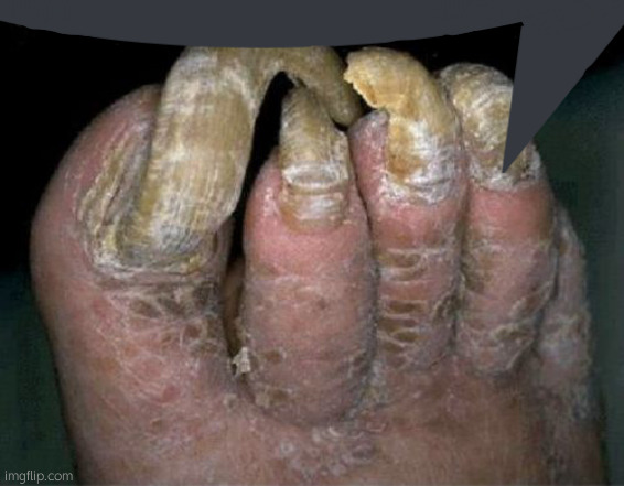 Toenails | image tagged in toenails | made w/ Imgflip meme maker