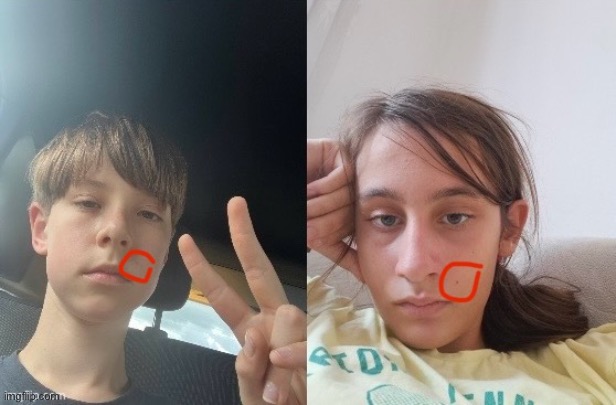 Dea and I just realized we both have a birthmark on the same place | image tagged in lol | made w/ Imgflip meme maker