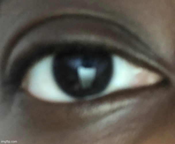 This is my eye | made w/ Imgflip meme maker