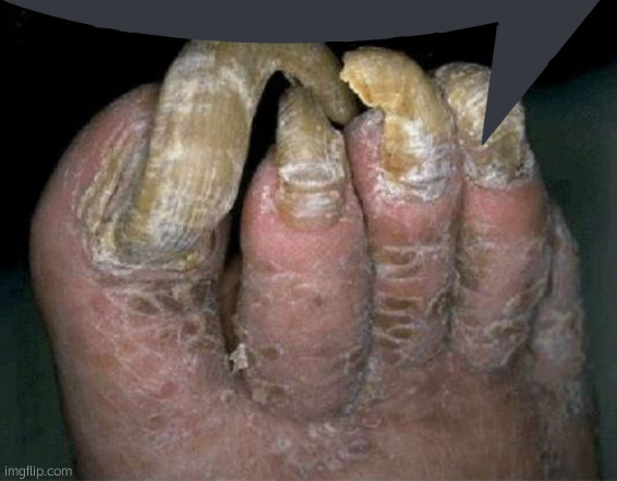 Toenails | image tagged in toenails | made w/ Imgflip meme maker