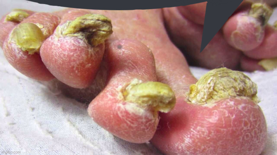 feet | image tagged in feet | made w/ Imgflip meme maker