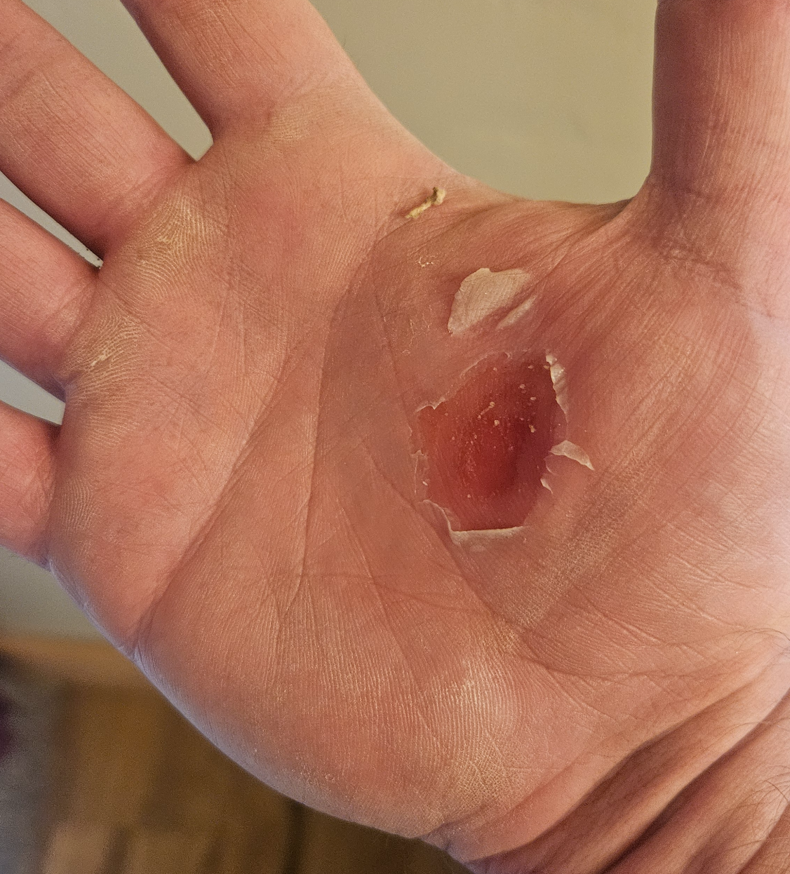 High Quality Blistered hand Blank Meme Template