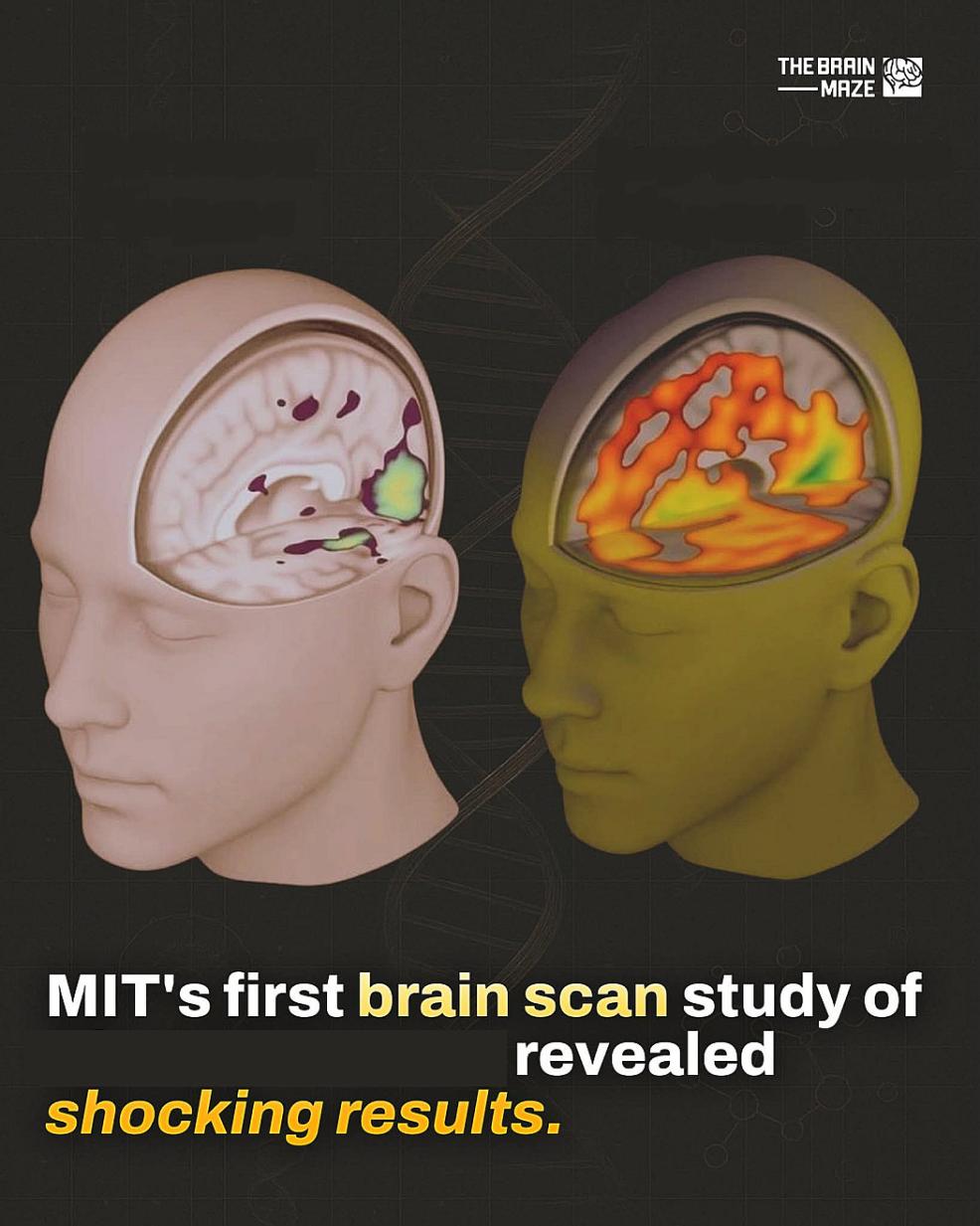 MIT brain scan Blank Meme Template