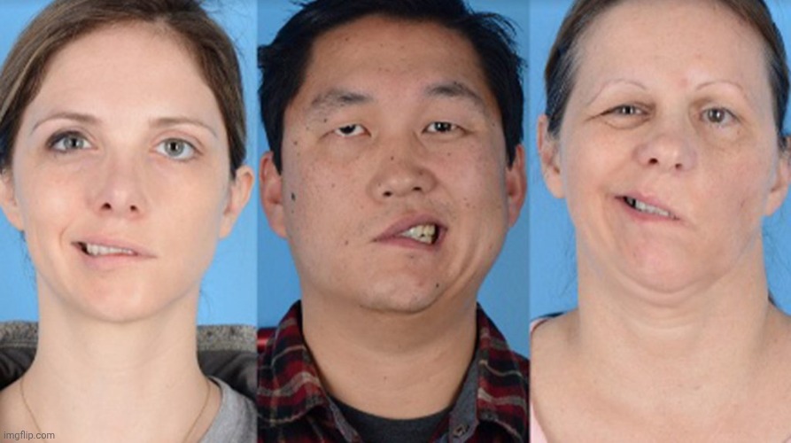 Covid Vaccine Bells Palsy | image tagged in covid vaccine bells palsy | made w/ Imgflip meme maker