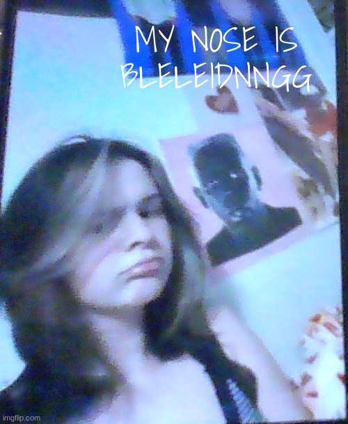 basically balb | MY NOSE IS BLELEIDNNGG | image tagged in basically balb | made w/ Imgflip meme maker