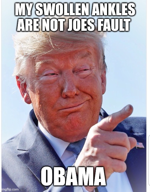 Trump pointing | MY SWOLLEN ANKLES ARE NOT JOES FAULT OBAMA | image tagged in trump pointing | made w/ Imgflip meme maker