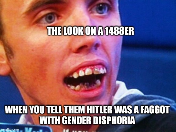 British Teeth  | THE LOOK ON A 1488ER; WHEN YOU TELL THEM HITLER WAS A FAGGOT 
WITH GENDER DISPHORIA | image tagged in british teeth | made w/ Imgflip meme maker