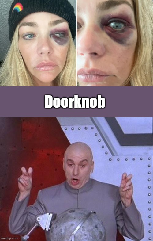 Why is it always the left eye the doorknob hits? It's like some kind of initiation | Doorknob | image tagged in memes,dr evil laser | made w/ Imgflip meme maker