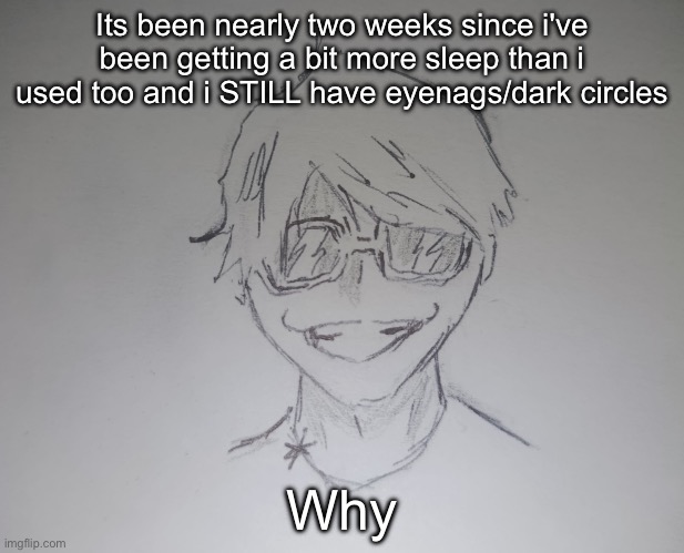 Brett Yang (thanks skul) | Its been nearly two weeks since i've been getting a bit more sleep than i used too and i STILL have eyenags/dark circles; Why | image tagged in brett yang thanks skul | made w/ Imgflip meme maker