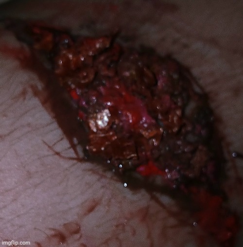 pics from a dog bite from earlier (i got stitcing dont worry) | made w/ Imgflip meme maker