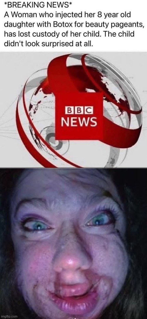 Botox mom | image tagged in botox,mom,beauty and the beast | made w/ Imgflip meme maker