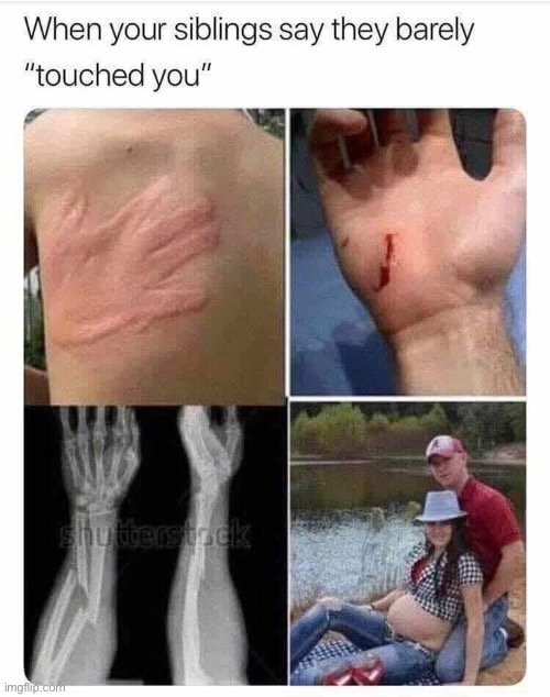 Sibling Love | image tagged in love,siblings,sibling rivalry,slap,tis but a scratch,sweet home alabama | made w/ Imgflip meme maker