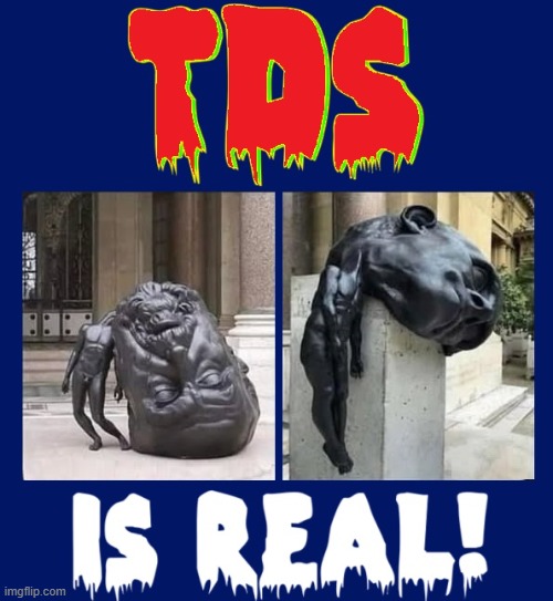SYMPTOM #1: You can't get Trump out of your head | image tagged in vince vance,tds,trump derangement syndrome,liberals,progressives,far left | made w/ Imgflip meme maker
