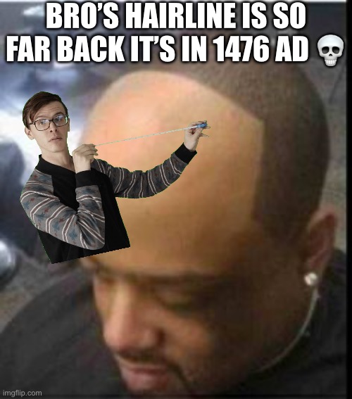 WAADAHEEEEEEEEL | BRO’S HAIRLINE IS SO FAR BACK IT’S IN 1476 AD 💀 | image tagged in hairline pushback | made w/ Imgflip meme maker