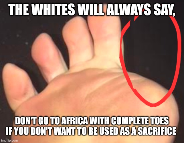 Missing toe | THE WHITES WILL ALWAYS SAY, DON'T GO TO AFRICA WITH COMPLETE TOES IF YOU DON'T WANT TO BE USED AS A SACRIFICE | image tagged in missing toe | made w/ Imgflip meme maker