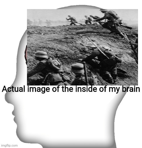 I got the ww1 autism </3 | image tagged in actual image of the inside of my brain | made w/ Imgflip meme maker