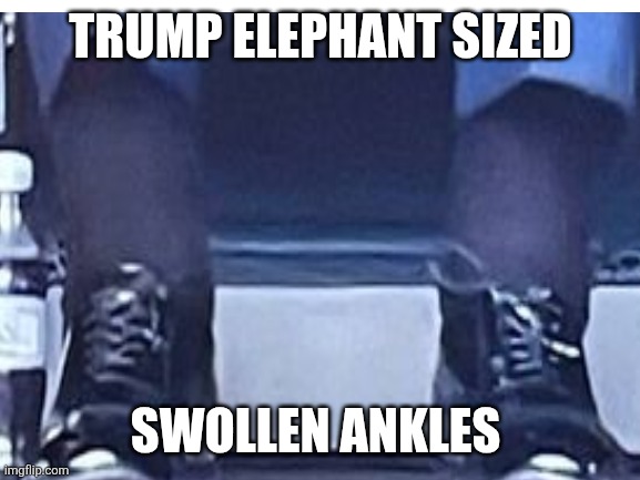 TRUMP ELEPHANT SIZED SWOLLEN ANKLES | made w/ Imgflip meme maker