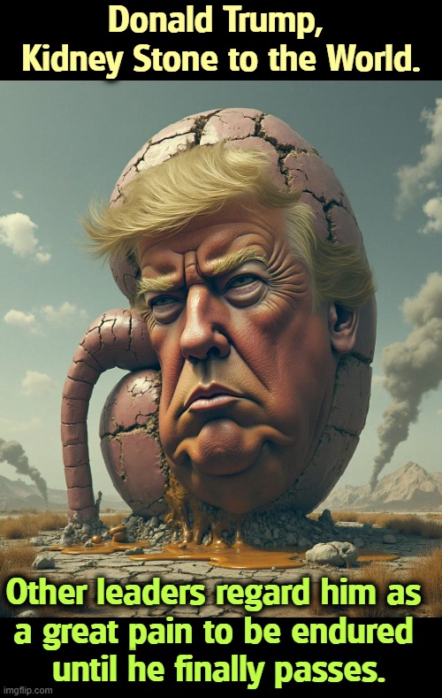 Donald Trump, 
Kidney Stone to the World. Other leaders regard him as 
a great pain to be endured 
until he finally passes. | image tagged in trump,kidney stone,pain,pass | made w/ Imgflip meme maker
