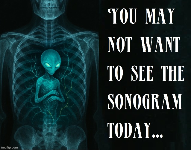 Never Trust Sonograms | image tagged in vince vance,sonogram,baby,alien,memes,sci-fi | made w/ Imgflip meme maker