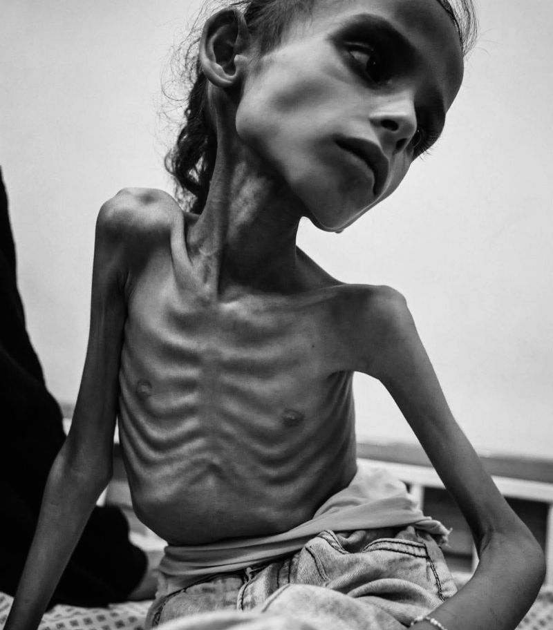 Famine in Gaza Blank Meme Template