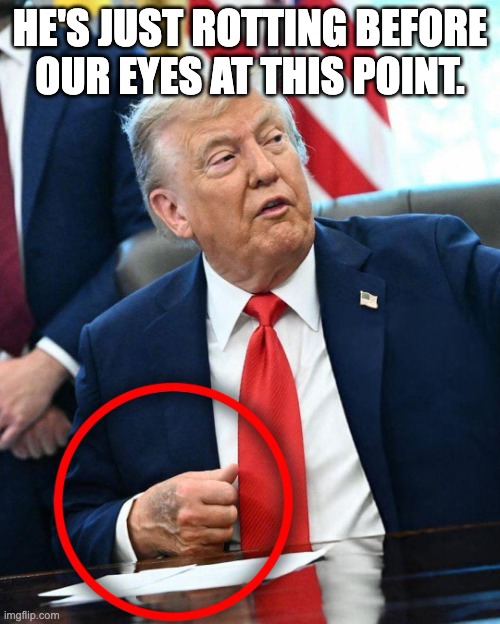Trump Rotting | HE'S JUST ROTTING BEFORE OUR EYES AT THIS POINT. | image tagged in trump rotting | made w/ Imgflip meme maker