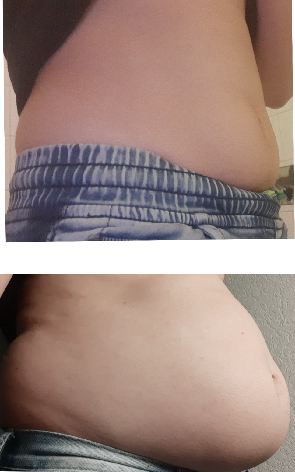 Fat Blank Meme Template