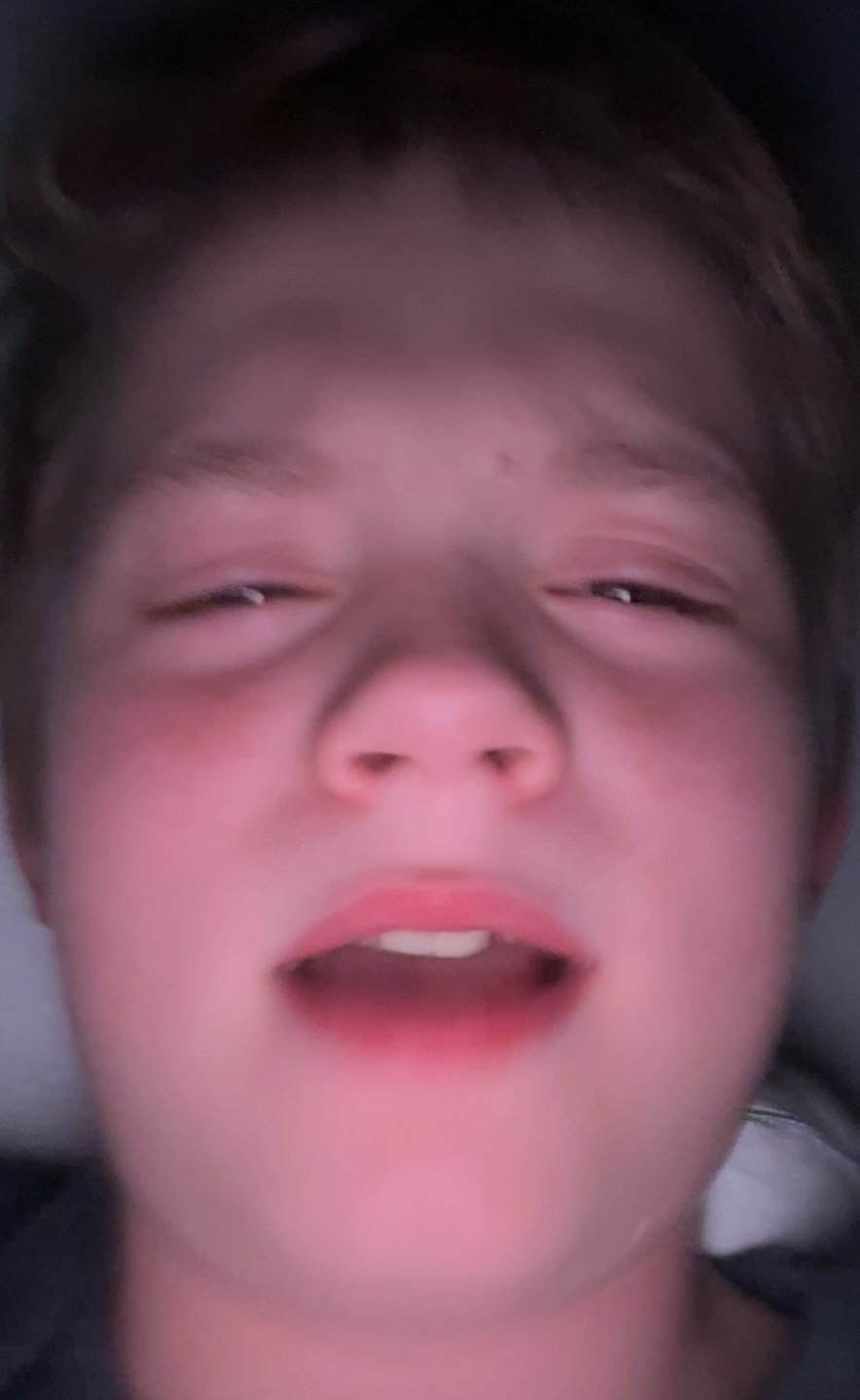 Autistic ahh Blank Meme Template