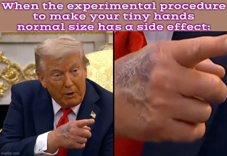 RFK Jr introduced him to an unlicensed doctor | When the experimental procedure
to make your tiny hands
normal size has a side effect: | image tagged in trump hand,mad scientist,health,unexpected results,mistake,plastic surgery | made w/ Imgflip meme maker
