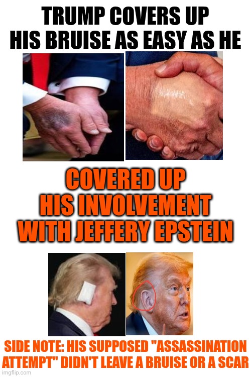 He's Just A Really BAD Actor With Gargantuan Delusions Of Grandure And Since No One Worthy Worships Him He Punishes Everyone | TRUMP COVERS UP HIS BRUISE AS EASY AS HE; COVERED UP HIS INVOLVEMENT WITH JEFFERY EPSTEIN; SIDE NOTE: HIS SUPPOSED "ASSASSINATION ATTEMPT" DIDN'T LEAVE A BRUISE OR A SCAR | image tagged in memes,delusional,maga,nazis,trump is a convicted felon,lock him up | made w/ Imgflip meme maker