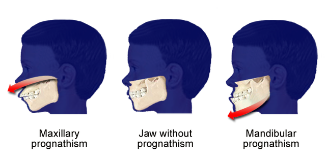save the Neanderthels Blank Meme Template