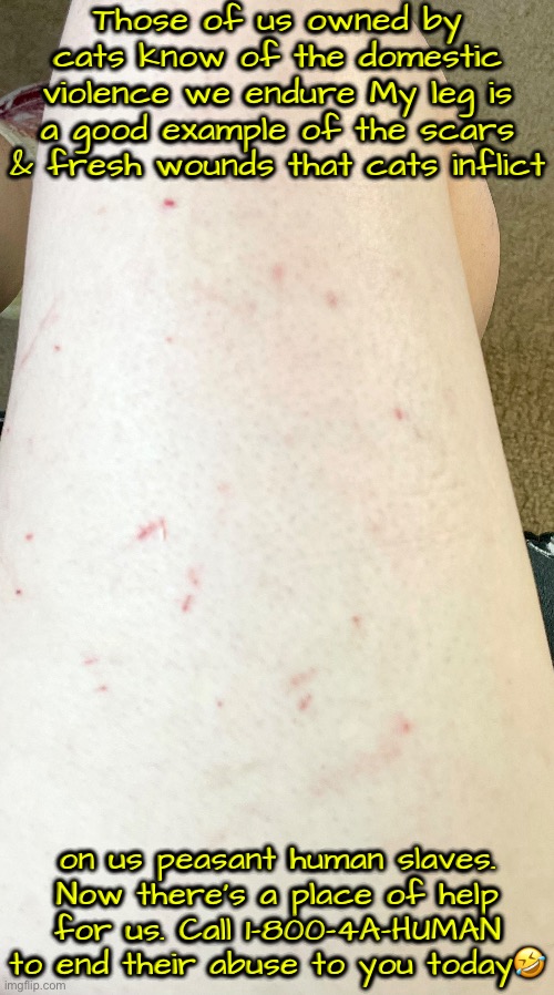 1-800-4A-HUMAN | Those of us owned by cats know of the domestic violence we endure My leg is a good example of the scars & fresh wounds that cats inflict; on us peasant human slaves. Now there's a place of help for us. Call 1-800-4A-HUMAN to end their abuse to you today🤣 | image tagged in cats,funny cats,tis but a scratch,domestic violence,help me,hilarious memes | made w/ Imgflip meme maker