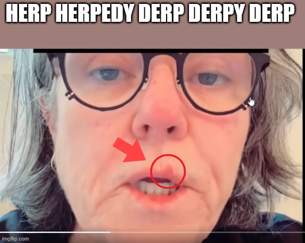 HERP HERPEDY DERP DERPY DERP | made w/ Imgflip meme maker
