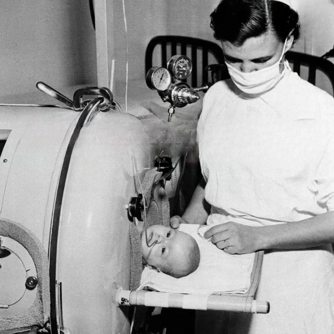 Baby in iron lung, pre-vaccine. Florida's finest. Blank Meme Template