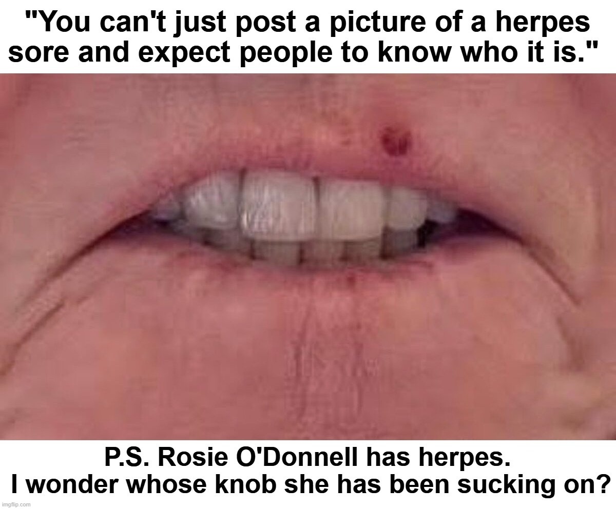 Make Herpes Great Again! | image tagged in rosie o'donnell,rosie,herpes,oral sex,cocksucker,blowjob | made w/ Imgflip meme maker