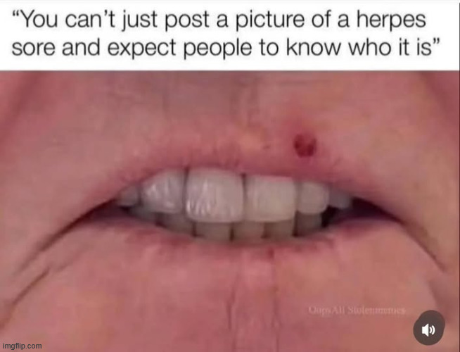 The face of herpes | image tagged in the face of herpes | made w/ Imgflip meme maker