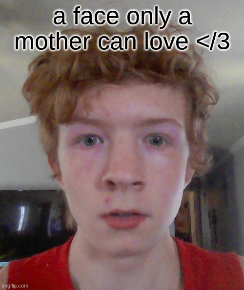 street rat ptsd | a face only a mother can love </3 | image tagged in street rat ptsd | made w/ Imgflip meme maker