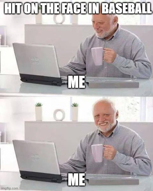 Hide the Pain Harold | HIT ON THE FACE IN BASEBALL; ME; ME | image tagged in memes,hide the pain harold,baseball | made w/ Imgflip meme maker