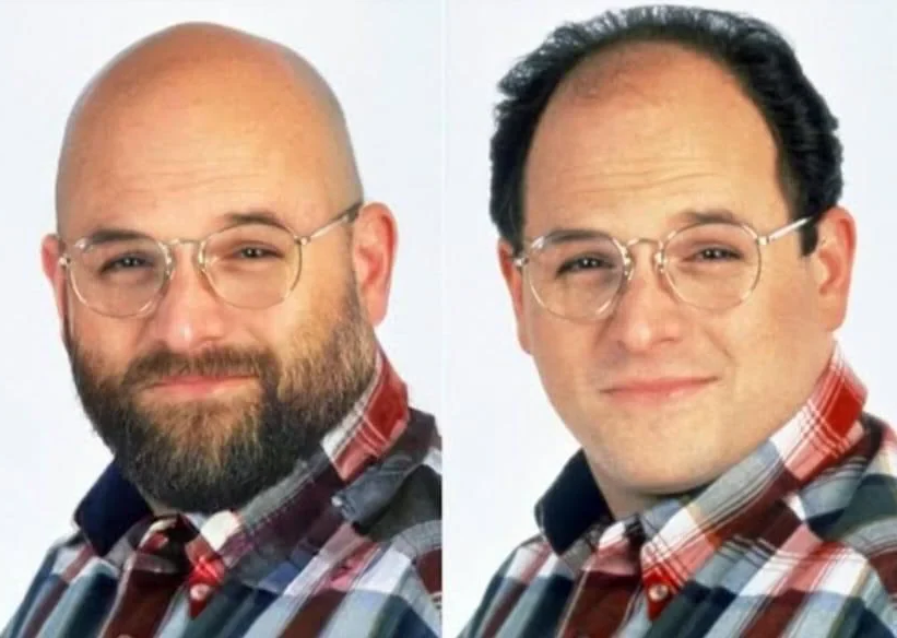 Bald or Balding Blank Meme Template