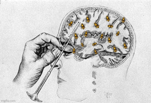 Lobotomy  | image tagged in lobotomy | made w/ Imgflip meme maker