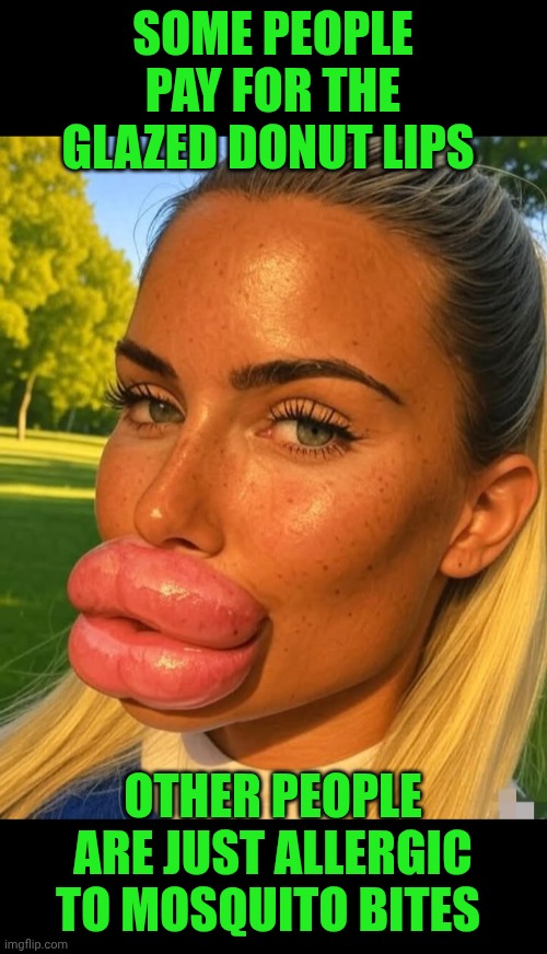 Funny | SOME PEOPLE PAY FOR THE GLAZED DONUT LIPS; OTHER PEOPLE ARE JUST ALLERGIC TO MOSQUITO BITES | image tagged in funny,allergies,lips,mosquito,donuts,bite | made w/ Imgflip meme maker