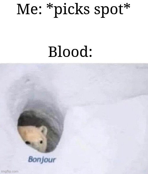 Very annoying | Me: *picks spot*; Blood: | image tagged in bonjour,annoying,memes,funny,relatable | made w/ Imgflip meme maker