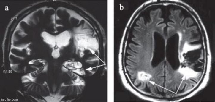 brain reveal | made w/ Imgflip meme maker