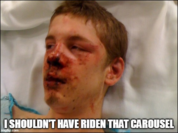 beat up guy | I SHOULDN'T HAVE RIDEN THAT CAROUSEL | image tagged in beat up guy | made w/ Imgflip meme maker