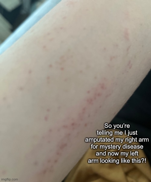 Imma be armless | So you’re telling me I just amputated my right arm for mystery disease and now my left arm looking like this?! | made w/ Imgflip meme maker