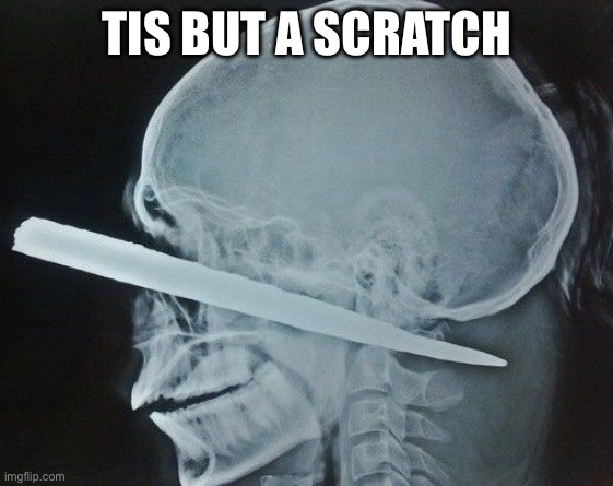 The X-Ray was fine, you can now go to the autopsy | TIS BUT A SCRATCH | image tagged in lobotomy,tis but a scratch | made w/ Imgflip meme maker