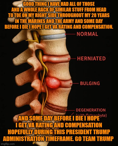 Funny | GOOD THING I HAVE HAD ALL OF THOSE AND A WHOLE RACK OF SIMILAR STUFF FROM HEAD TO TOE ON MY RIGHT SIDE THROUGHOUT MY 28 YEARS IN THE MARINES AND THE ARMY AND SOME DAY BEFORE I DIE I HOPE I GET VA RATING AND COMPENSATION. AND SOME DAY BEFORE I DIE I HOPE I GET VA RATING AND COMPENSATION HOPEFULLY DURING THIS PRESIDENT TRUMP ADMINISTRATION TIMEFRAME. GO TEAM TRUMP | image tagged in funny,president trump,politics,veterans,disabled,injuries | made w/ Imgflip meme maker