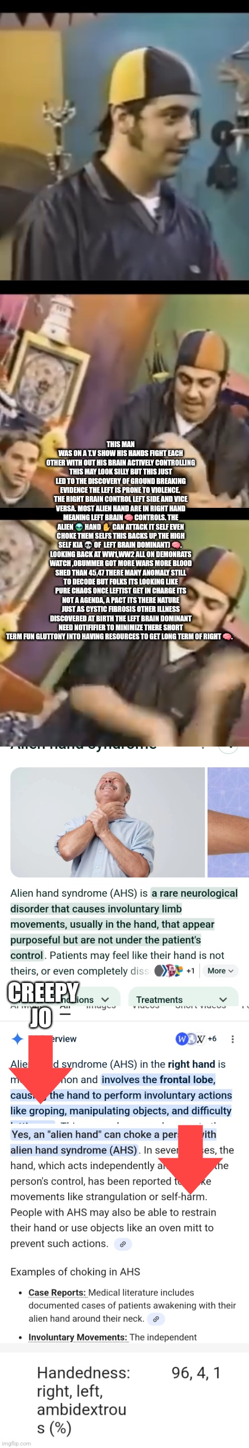 Readers highgest : Breaking medical Discovery by decoder, demonrats aren't happy about it! | THIS MAN WAS ON A T.V SHOW HIS HANDS FIGHT EACH OTHER WITH OUT HIS BRAIN ACTIVELY CONTROLLING THIS MAY LOOK SILLY BUT THIS JUST LED TO THE DISCOVERY OF GROUND BREAKING EVIDENCE THE LEFT IS PRONE TO VIOLENCE.  THE RIGHT BRAIN CONTROL LEFT SIDE AND VICE VERSA. MOST ALIEN HAND ARE IN RIGHT HAND MEANING LEFT BRAIN 🧠 CONTROLS. THE ALIEN 👽 HAND ✋️ CAN ATTACK IT SELF EVEN CHOKE THEM SELFS THIS BACKS UP THE HIGH SELF KIA 💀 OF  LEFT BRAIN DOMINANT) 🧠.  LOOKING BACK AT WW1,WW2 ALL ON DEMONRATS WATCH ,OBUMMER GOT MORE WARS MORE BLOOD SHED THAN 45,47 THERE MANY ANOMALY STILL TO DECODE BUT FOLKS ITS LOOKING LIKE PURE CHAOS ONCE LEFTIST GET IN CHARGE ITS NOT A AGENDA, A PACT ITS THERE NATURE JUST AS CYSTIC FIBROSIS OTHER ILLNESS DISCOVERED AT BIRTH THE LEFT BRAIN DOMINANT NEED NOTIFIFIER TO MINIMIZE THERE SHORT TERM FUN GLUTTONY INTO HAVING RESOURCES TO GET LONG TERM OF RIGHT 🧠. CREEPY JO | image tagged in decode,left,art | made w/ Imgflip meme maker