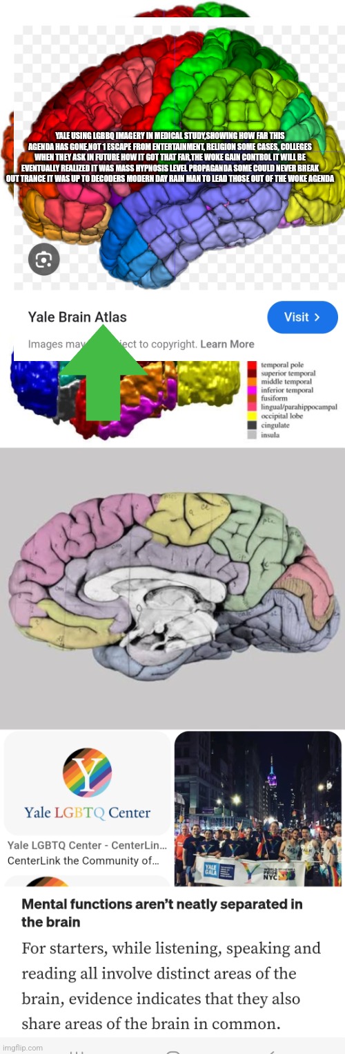 Readers highgest : The woke agenda just got worse! There replacing it all with LGBT & there caught! | YALE USING LGBBQ IMAGERY IN MEDICAL STUDY,SHOWING HOW FAR THIS AGENDA HAS GONE,NOT 1 ESCAPE FROM ENTERTAINMENT, RELIGION SOME CASES, COLLEGES WHEN THEY ASK IN FUTURE HOW IT GOT THAT FAR,THE WOKE GAIN CONTROL IT WILL BE EVENTUALLY REALIZED IT WAS MASS HYPNOSIS LEVEL PROPAGANDA SOME COULD NEVER BREAK OUT TRANCE IT WAS UP TO DECODERS MODERN DAY RAIN MAN TO LEAD THOSE OUT OF THE WOKE AGENDA | image tagged in woke,left | made w/ Imgflip meme maker