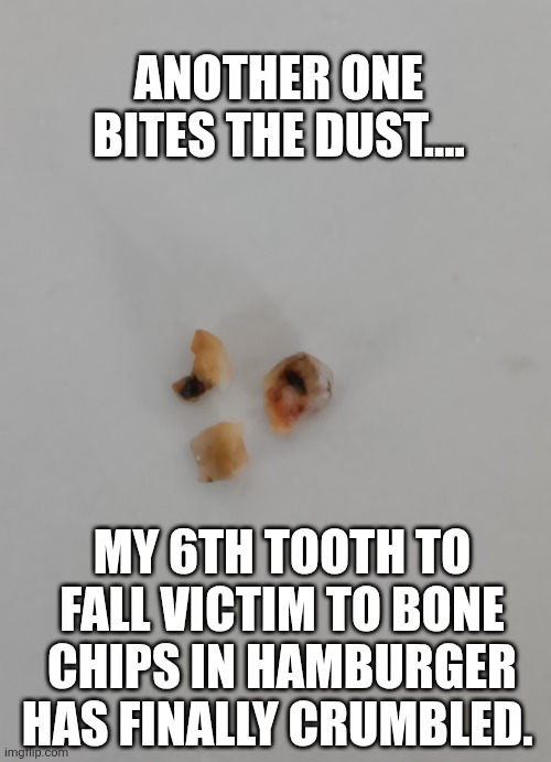 Another one bites the dust | ANOTHER ONE BITES THE DUST.... MY 6TH TOOTH TO FALL VICTIM TO BONE CHIPS IN HAMBURGER HAS FINALLY CRUMBLED. | image tagged in toothless,tooth,boner,disaster,oops,original meme | made w/ Imgflip meme maker